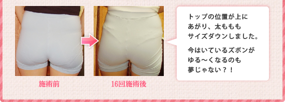トップの位置が上にあがり、太もももサイズダウンしました。今はいているズボンがゆる～くなるのも夢じゃない？！