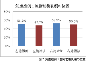 図7 気虚症例1施術前後乳頭の位置