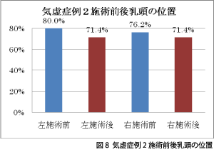 図8 気虚症例2施術前後乳頭の位置