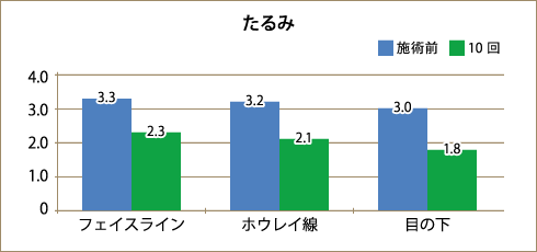 たるみ