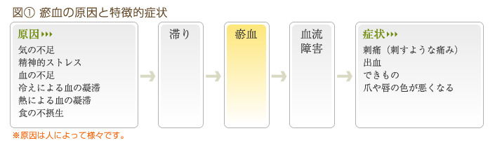 瘀血の原因と特徴的症状